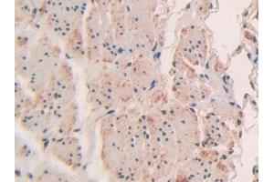Immunohistochemistry (IHC) image for anti-SP100 Nuclear Antigen (SP100) (AA 610-802) antibody (ABIN7442741)