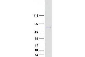 Western Blotting (WB) image for Smu-1 Suppressor of Mec-8 and Unc-52 Homolog (SMU1) protein (Myc-DYKDDDDK Tag) (ABIN2732265)