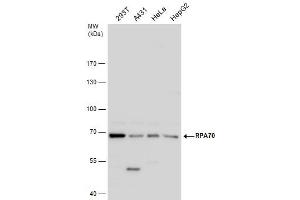 WB Image RPA70 antibody detects RPA70 protein by western blot analysis. (RPA1 抗体  (C-Term))