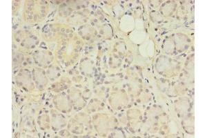 Immunohistochemistry (IHC) image for anti-ArfGAP with Coiled-Coil, Ankyrin Repeat and PH Domains 1 (ACAP1) (AA 1-266) antibody (ABIN7144554)