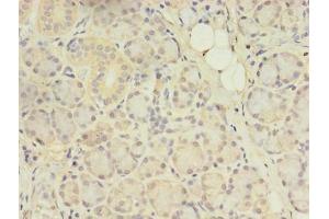 Immunohistochemistry of paraffin-embedded human pancreatic tissue using ABIN7144554 at dilution of 1:100 (ACAP1 抗体  (AA 1-266))