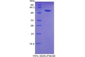 SDS-PAGE analysis of Human Glucose Transporter 14 Protein.