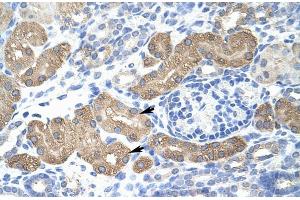 Human kidney; Rabbit Anti-L3MBTL2 Antibody. (L3MBTL2 抗体  (C-Term))