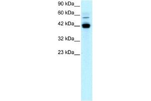 WB Suggested Anti-EGR1 Antibody Titration: 1 ug/ml Positive Control: Jurkat cell lysate (EGR1 抗体  (N-Term))