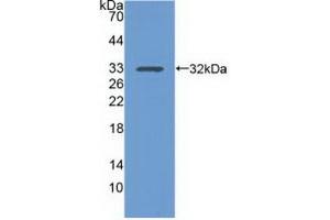 Detection of Recombinant ITGa1, Human using Polyclonal Antibody to Integrin Alpha 1 (ITGa1) (Integrin alpha 1 抗体  (AA 125-366))