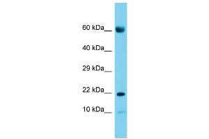 Host: Rabbit Target Name: CNIH2 Sample Type: Placenta lysates Antibody Dilution: 1.
