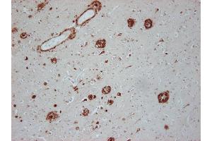 Immunostaining of paraffin embedded brain section from an Alzheimer's patient (dilution 1 : 100). (Abeta 1-42 抗体  (AA 37-42))