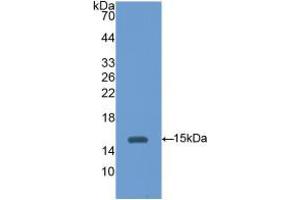 Western blot analysis of recombinant Mouse HEXb. (HEXB 抗体  (AA 101-217))