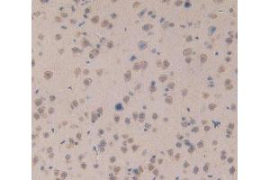 Used in DAB staining on fromalin fixed paraffin- embedded brain tissue (PKC mu 抗体  (AA 349-612))