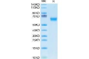 DDR1 Protein (AA 21-417) (His tag)