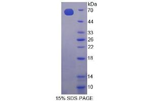 SDS-PAGE analysis of Mouse CHKa Protein. (Choline Kinase alpha Protein (CHKA))