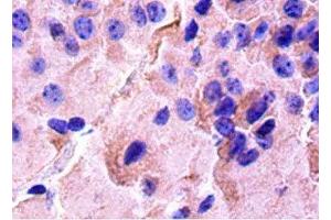 Immunohistochemistry (IHC) image for anti-cAMP Responsive Element Binding Protein 1 (CREB1) (AA 1-341) antibody (ABIN7148811)