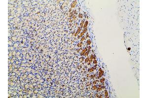 Immunohistochemistry (IHC) image for anti-Phosphoinositide 3 Kinase, p85 alpha (PI3K p85a) (pTyr607) antibody (ABIN6256775)