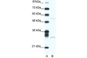 WB Suggested Anti-ATF4  Antibody Titration: 5. (ATF4 抗体  (C-Term))