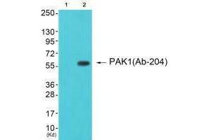 Western blot analysis of extracts from cos-7 cells (Lane 2), using PAK1 (Ab-204) antiobdy. (PAK1 抗体  (Ser204))