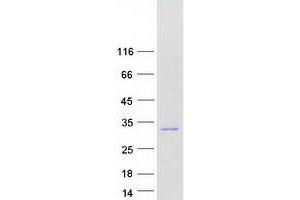 FGFBP2 Protein (Myc-DYKDDDDK Tag)