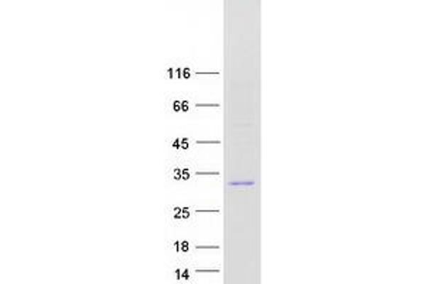FGFBP2 Protein (Myc-DYKDDDDK Tag)
