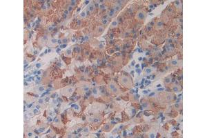 Used in DAB staining on fromalin fixed paraffin- embedded stomach tissue (Neuregulin 2 抗体  (AA 618-836))