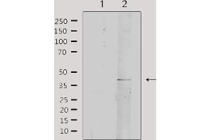 Western blot analysis of lysates from rat brain, using Collagen IV α2 Antibody.