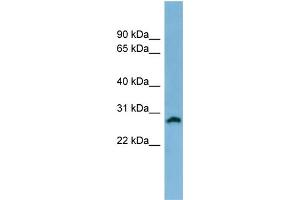 Western Blotting (WB) image for anti-Steroid-5-alpha-Reductase, alpha Polypeptide 2 (3-Oxo-5 alpha-Steroid delta 4-Dehydrogenase alpha 2) (SRD5A2) (N-Term) antibody (ABIN2781789)