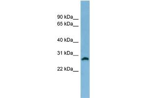 WB Suggested Anti-SRD5A2 Antibody Titration: 0.