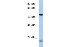 Western Blot showing PLAGL1 antibody used at a concentration of 1-2 ug/ml to detect its target protein.