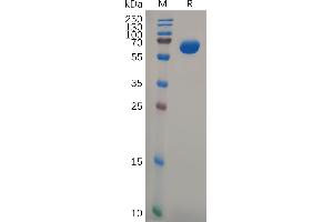 Human Protein, hFc Tag on SDS-PAGE under reducing condition.