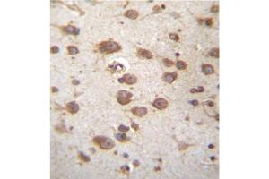 Immunohistochemistry (Paraffin-embedded Sections) (IHC (p)) image for anti-Signal Transducing Adaptor Family Member 2 (STAP2) (AA 194-224), (Middle Region) antibody (ABIN954969)
