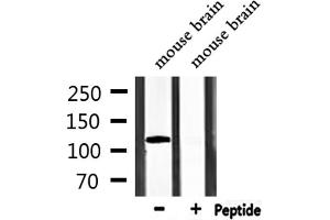 Western blot analysis of extracts from mouse brain, using TRPM8 Antibody. (TRPM8 抗体)