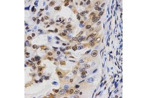 Immunohistochemistry (IHC) image for anti-Histone 3 (H3) (H3K36me3) antibody (ABIN3016039)