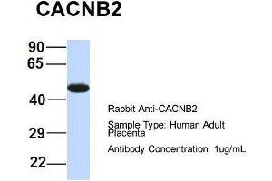 Host:  Rabbit  Target Name:  CACNB2  Sample Type:  Human Adult Placenta  Antibody Dilution:  1. (CACNB4 抗体  (Middle Region))