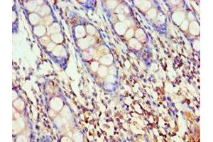 Immunohistochemistry of paraffin-embedded human colon tissue using ABIN7142909 at dilution of 1:100 (AKAP5 抗体  (AA 1-270))