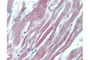 Anti-GALR2 antibody IHC of human heart. (GALR2 抗体  (AA 212-277))
