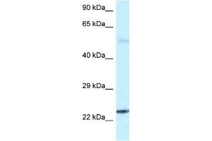 Western Blot showing RAB31 antibody used at a concentration of 1 ug/ml against Fetal Brain Lysate (RAB31 抗体  (C-Term))