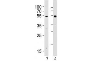 Western blot analysis of lysate from 1) human Raji cell line and 2) rat spleen tissue lysate using Lyn antibody. (LYN 抗体  (AA 229-263))