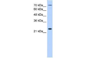 WB Suggested Anti-CLDN2 Antibody Titration:  1. (Claudin 2 抗体  (N-Term))