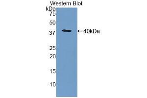 Western blot analysis of the recombinant protein. (CCL5 抗体  (AA 24-91))