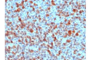 Immunohistochemistry (IHC) image for anti-S100 Calcium Binding Protein B (S100B) antibody (ABIN6940561)