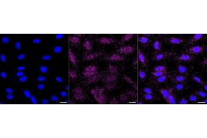 Immunocytochemical staining of H9C2 cells with Prolyl endopeptidase like antibody (ABIN7799923), 1:1,000). (Recombinant PREPL 抗体)