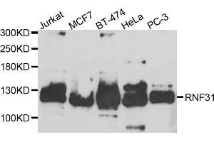Western blot analysis of extracts of various cell lines, using RNF31 antibody. (RNF31 抗体)
