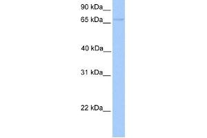 WB Suggested Anti-FOXO1 Antibody Titration:  0. (FOXO1 抗体  (Middle Region))