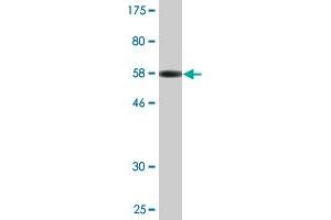 Western Blot detection against Immunogen (56. (XPO5 抗体  (AA 1-280))