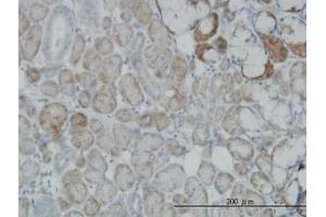 Image no. 6 for anti-Oxidative-Stress Responsive 1 (OXSR1) (AA 1-528) antibody (ABIN599106) (OXSR1 抗体  (AA 1-528))