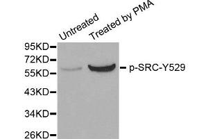 Western Blotting (WB) image for anti-Proto-oncogene tyrosine-protein kinase Src (Src) (pTyr529) antibody (ABIN1870630) (Src 抗体  (pTyr529))