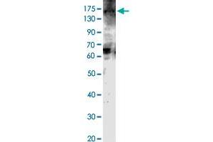 Western blot analysis of JMJD2C protein with JMJD2C polyclonal antibody . (KDM4C 抗体  (AA 502-520))