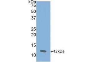 Detection of Recombinant IL8, Equine using Polyclonal Antibody to Interleukin 8 (IL8) (IL-8 抗体  (AA 23-101))