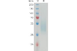 SDS-PAGE (SDS) image for V-Set Domain Containing T Cell Activation Inhibitor 1 (VTCN1) (AA 29-256) protein (His tag) (ABIN7538585)