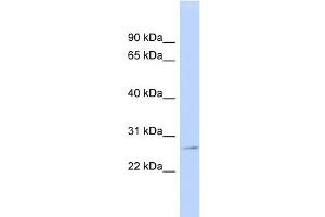 WB Suggested Anti-GSTP1 Antibody Titration:  0. (GSTP1 抗体  (N-Term))
