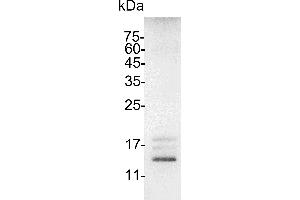 Interleukin 15 (IL15) (Active) protein (His tag)