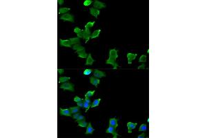 Immunofluorescence analysis of MCF-7 cells using GLUL antibody. (GLUL 抗体)